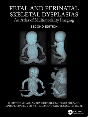 Fetal and Perinatal Skeletal Dysplasias