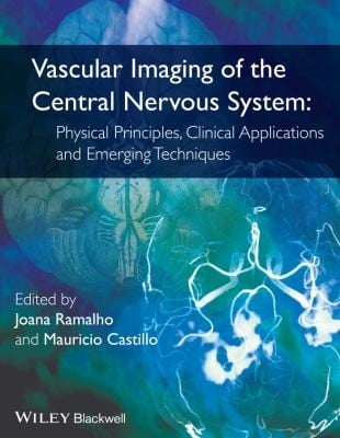 Vascular Imaging Of The Central Nervous System Physical Principles Clinical Applications And Emerging Techniques
