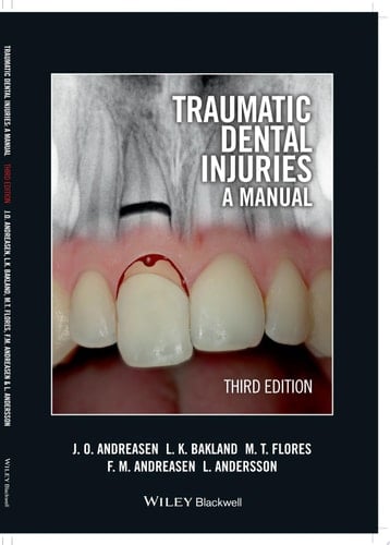Traumatic Dental Injuries A Manual