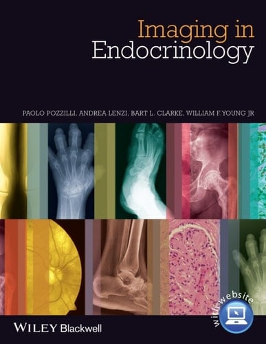Imaging in Endocrinology