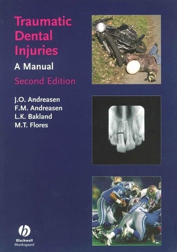 Traumatic Dental Injuries A Manual