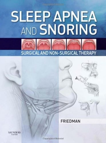Sleep apnea and snoring