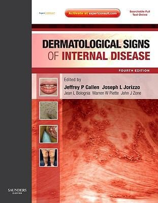 Dermatological Signs Of Internal Disease