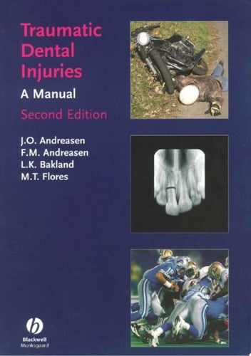 Traumatic Dental Injuries A Manual