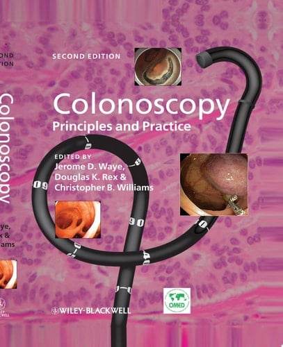 Colonoscopy Principles and Practice