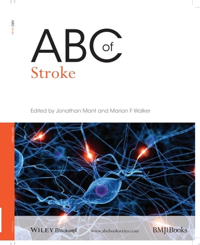 ABC of Stroke
