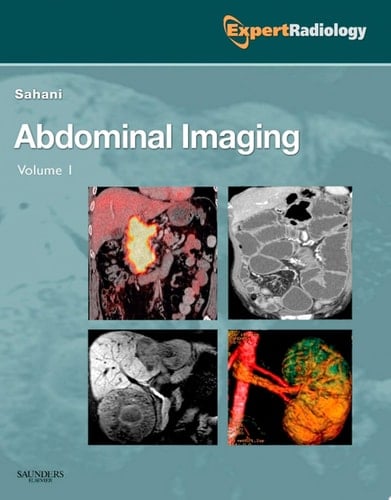 Abdominal Imaging E-Book Expert Radiology Series