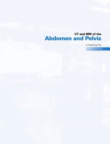 CT & MRI of the Abdomen and Pelvis A Teaching File