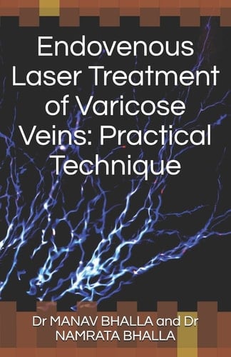 Endovenous Laser Treatment of Varicose Veins Practical Technique