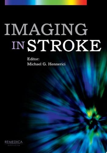 Imaging in Stroke