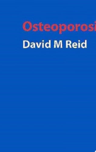 Handbook of Osteoporosis