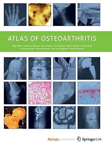 Atlas of Osteoarthritis