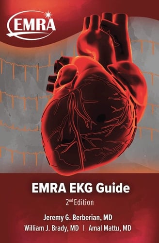 EMRA EKG Guide 2nd Edition