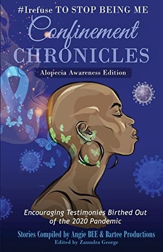 #Irefuse to Stop Being Me Confinement Chronicles - Alopecia Awareness Edition