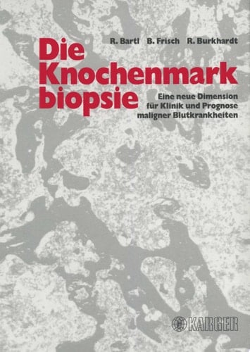 Die Knochenmarkbiopsie Eine neue Dimension für Klinik und Prognose maligner Blutkrankheiten