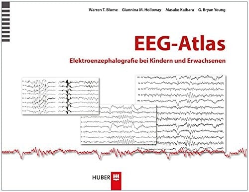 EEG-Atlas Elektroenzephalografie bei Kindern und Erwachsenen