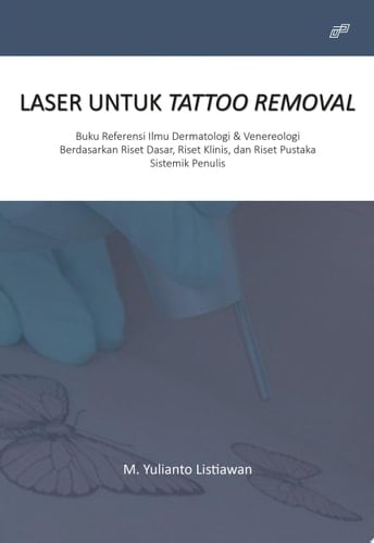 LASER UNTUK TATTOO REMOVAL