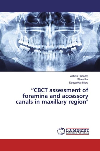 “CBCT assessment of foramina and accessory canals in maxillary region"
