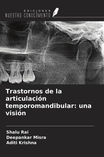 Trastornos de la articulación temporomandibular: una visión (Spanish Edition)