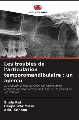 Les troubles de l'articulation temporomandibulaire : un aperçu: De l'anatomie et des fonctions de l'articulation temporo-mandibulaire au diagnostic et à la gestion de ses troubles (French Edition)
