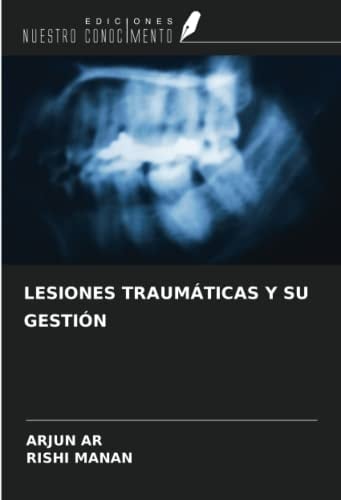 LESIONES TRAUMÁTICAS Y SU GESTIÓN (Spanish Edition)