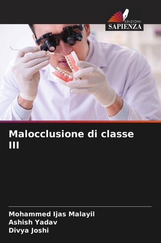 Malocclusione di classe III (Italian Edition)