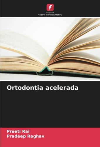 Ortodontia acelerada (Portuguese Edition)