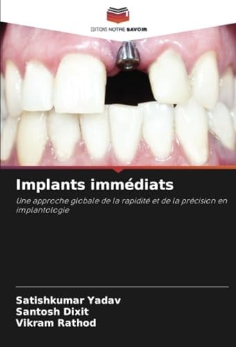 Implants immédiats: Une approche globale de la rapidité et de la précision en implantologie (French Edition)