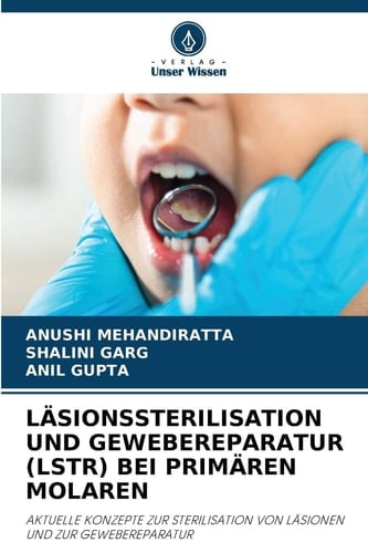 Läsionssterilisation Und Gewebereparatur (Lstr) Bei Primären Molaren (German Edition)