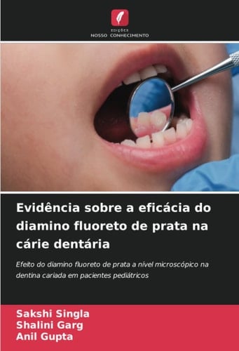 Evidência sobre a eficácia do diamino fluoreto de prata na cárie dentária: Efeito do diamino fluoreto de prata a nível microscópico na dentina cariada em pacientes pediátricos (Portuguese Edition)