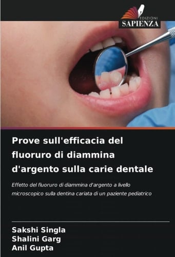 Prove sull'efficacia del fluoruro di diammina d'argento sulla carie dentale: Effetto del fluoruro di diammina d'argento a livello microscopico sulla ... di un paziente pediatrico (Italian Edition)