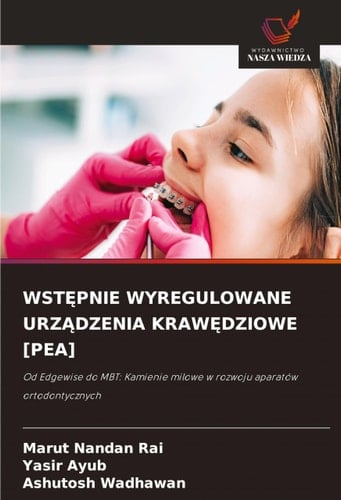WstĘpnie Wyregulowane UrzĄdzenia KrawĘdziowe [Pea]