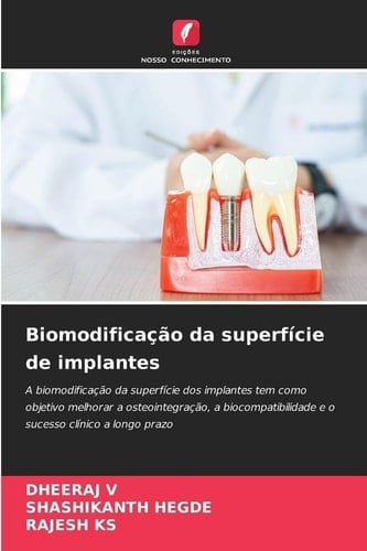 Biomodificação da superfície de implantes (Portuguese Edition)