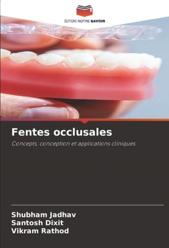 Fentes occlusales: Concepts, conception et applications cliniques (French Edition)