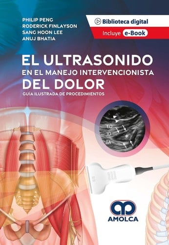 El ultrasonido en el manejo intervencionista del dolor guía ilustrada de procedimientos