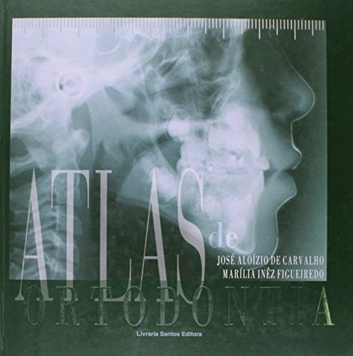 Atlas De Ortodontia