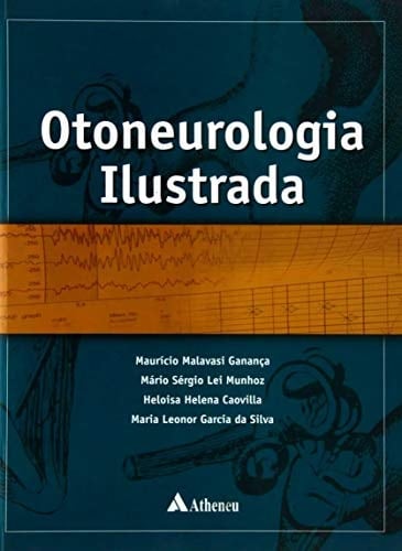 Otoneurologia ilustrada