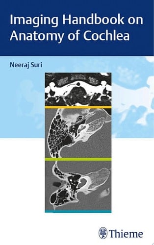 Imaging Handbook on Anatomy of Cochlea