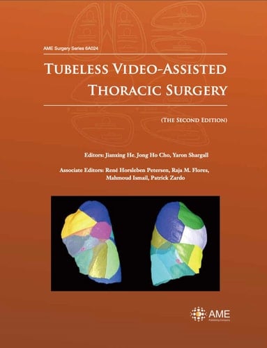 Tubeless Video-Assisted Thoracic Surgery (The Second Edition)