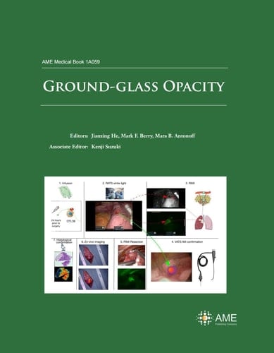 Ground-glass Opacity