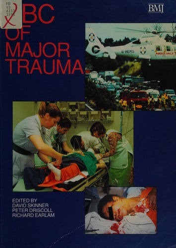 ABC of major trauma