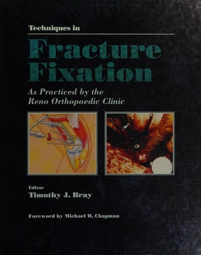 Techniques in fracture fixation