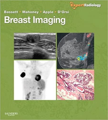 Breast imaging