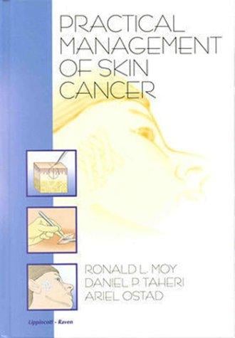 Practical management of skin cancer