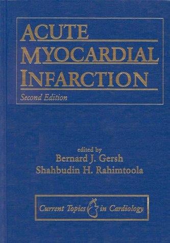 Acute myocardial infarction