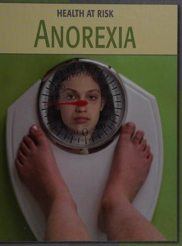 Anorexia