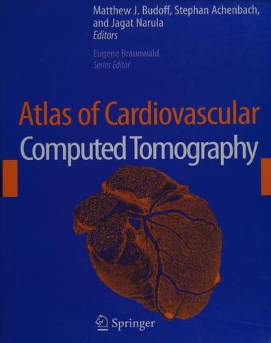 Atlas of cardiovascular computed tomography