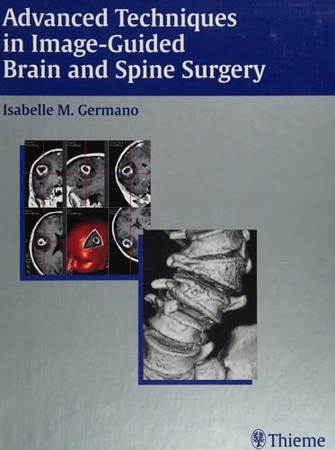 Advanced techniques in image-guided brain and spine surgery