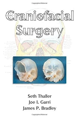 Craniofacial surgery