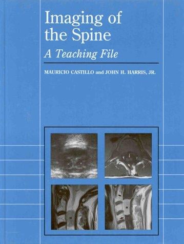 Imaging of the spine